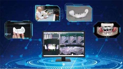 口腔種植手術(shù)導(dǎo)航定位系統(tǒng)同品種臨床評價注冊審查指導(dǎo)原則(2021年第93號)(圖1) 口腔種植手術(shù)導(dǎo)航定位系統(tǒng)同品種臨床評價注冊審查指導(dǎo)原則(2021年第93號)(圖1)