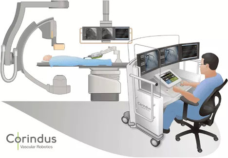 血管腔內(nèi)介入手術(shù)機器人首例臨床試驗案例及未來發(fā)展方向(圖2)